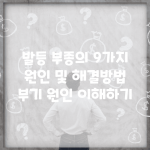 발등 부종의 9가지 원인 및 해결방법 | 부기 원인 이해하기